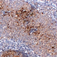 CD23 antibody