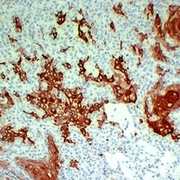 Cytokeratin 16 antibody