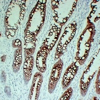 Anti-Cytokeratin 20 Antibody
