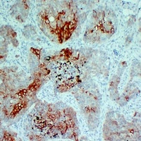 Cytokeratin 5/6 antibody