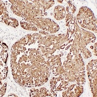 MUC1 antibody