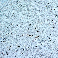 Anti-Factor XIIIa Antibody