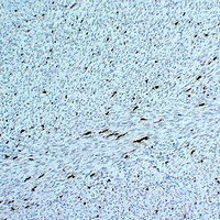 Factor XIIIa antibody