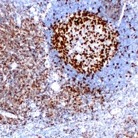 Anti-CD279 Antibody