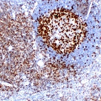 PD1 antibody