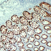 Anti-ALK5 Antibody
