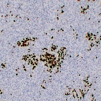 Anti-BOB1 Antibody