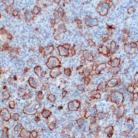 Anti-CD61 Antibody