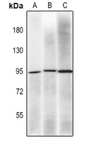 Anti-MLH1 Antibody