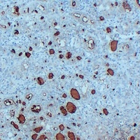 Thyroglobulin antibody