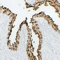 Uroplakin 3a antibody
