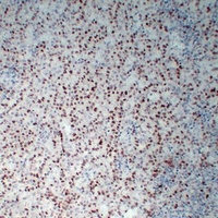 Anti-Wilms Tumor 1 Antibody