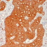 Calretinin antibody
