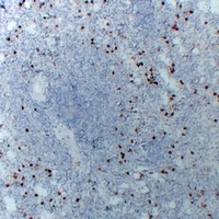 Anti-CD14 Antibody