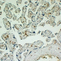 CD163 antibody