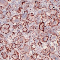 Anti-CD61 Antibody