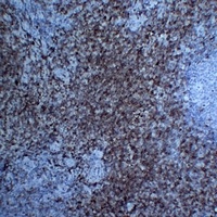 CD7 antibody