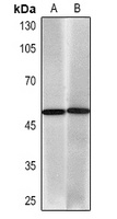 Cytokeratin 17 antibody