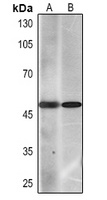 Anti-Cytokeratin 7 Antibody