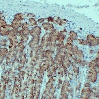 Anti-Claudin 18 Antibody