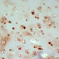 Anti-Collagen 2 alpha 1 Antibody