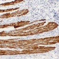 Anti-Desmin Antibody