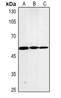 Fascin antibody