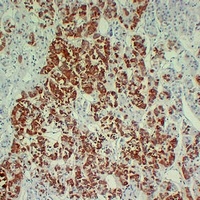 GH1 antibody