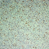 Anti-Ki67 Antibody