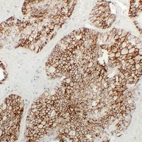 Anti-KSP Cadherin Antibody