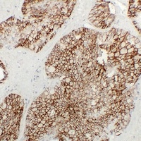 KSP Cadherin antibody