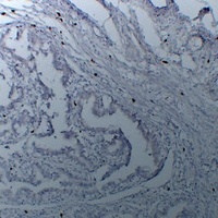 TPSAB1 antibody