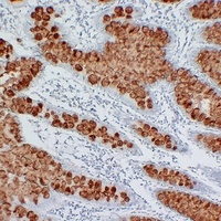 Anti-MUC2 Antibody