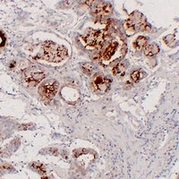 MUC6 antibody