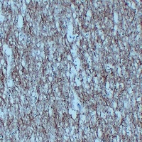 Anti-NEFL Antibody