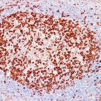 PD1 antibody