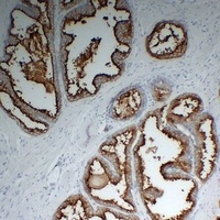 PSMA antibody