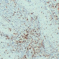 Anti-S100-A4 Antibody