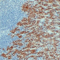 Anti-S100-A1 Antibody