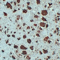 ACP5 antibody