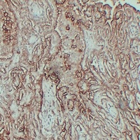 Anti-MUC16 Antibody