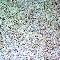 CD5 antibody