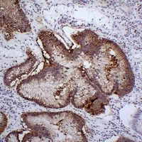 Claudin 18 antibody