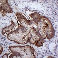 Anti-Claudin 18 Antibody