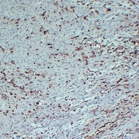 Anti-S100-A4 Antibody