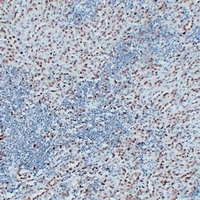 Anti-Wilms Tumor 1 Antibody