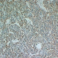 Anti-Tyrosinase Antibody