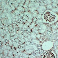 Anti-CD105 Antibody