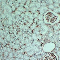 CD105 antibody