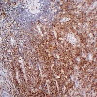 Anti-CD38 Antibody